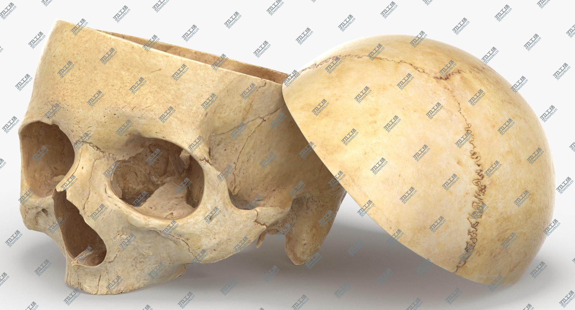 images/goods_img/202104091/Real Human Skull Cranial 02 Cut With Piece Pose 02 model/5.jpg